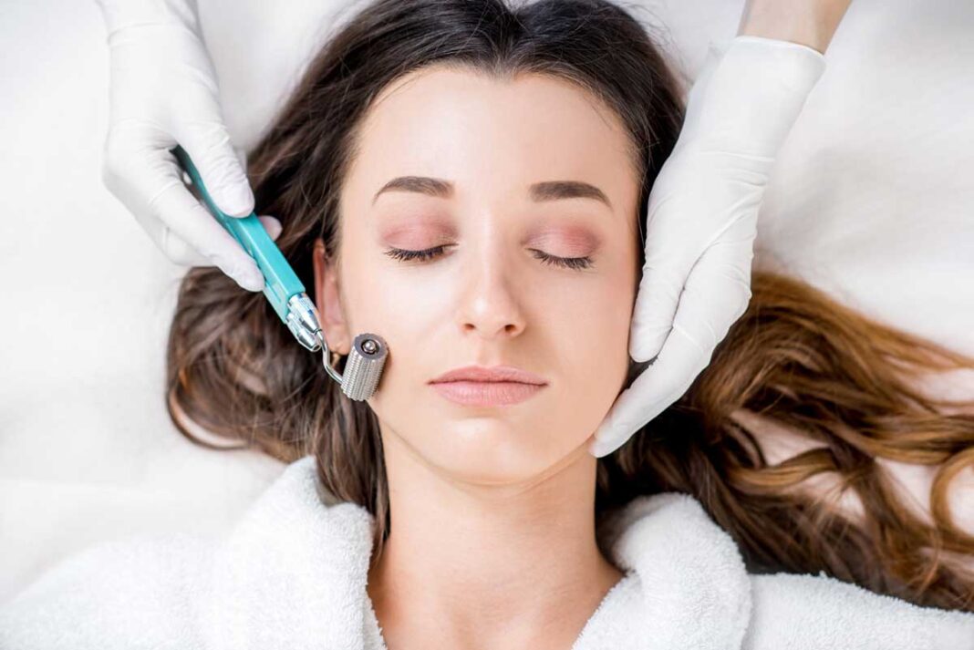 microneedling tretman