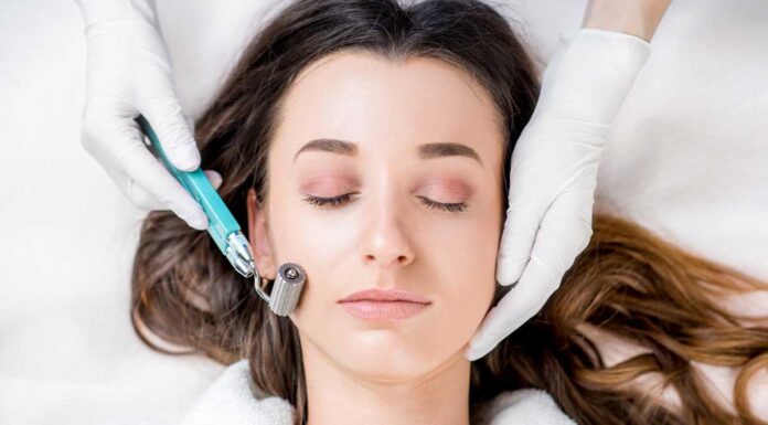 Microneedling: Sve što trebate znati o ovom tretmanu za obnovu kože microneedling tretman